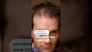 Hair Transplant Time LapseAffirmative Hair Solutions turkeyhairtransplant turkeyhairclinic [upl. by Ultima]