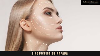 Antes de hacerte la Lipo de papada ¡Tienes que ver este vídeo [upl. by Ruthe884]