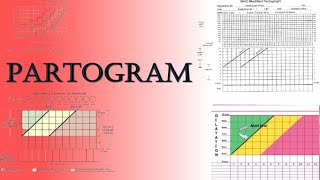 Partogram  Labour Monitoring and Assessment of Fetal WellBeing  TOACS amp OSCE Station [upl. by Bernie]