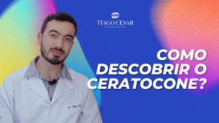 Como descobrir o CERATOCONE  Dr Tiago César Oftalmologista BH [upl. by Anelrats]