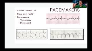 EKG Treating Dysrhythmias [upl. by Linnie837]