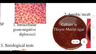 Meningococcal meningitis [upl. by Eltsyek]