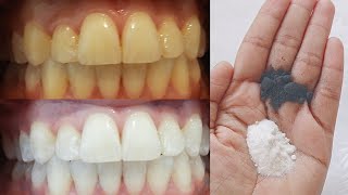 Teeth whitening at home in 2 minutes  Permanent teeth whitening  Home remedies for teeth whitening [upl. by Esaertal]