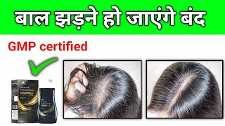 anti dandruff shampoo ketofresh z  ketofresh z shampoo ketofresh z shampoo review [upl. by Divd219]