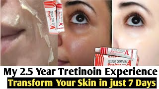 Tretinoin Creamafter using 1 Year full details002500501Pm Skincare with retinAin 2022 [upl. by Omura529]