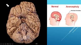 4 neuroscience tutorials QampA [upl. by Leinahtan]