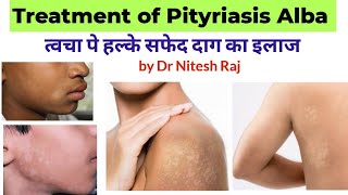 सफेद दाग का इलाजPityriasis Alba treatment in hindi drniteshraj [upl. by Yeblehs]