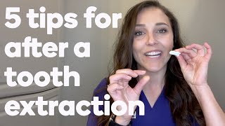 5 things to do after your tooth is extracted [upl. by Vyner]