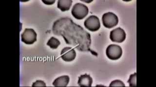 Neutrophil Phagocytosis  White Blood Cell Eats Staphylococcus Aureus Bacteria [upl. by Ansell233]