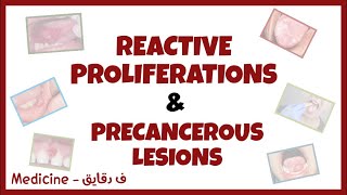 Oral lesions part 2  reactive proliferationsamp precancerous lesions leukoplakia erythroplakia شرح [upl. by Amethist]