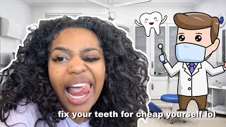 DIY VENEERS TUTORIAL  FIXING ALL GAPS IN MY TEETH MYSELF WITH COMPOSITE  BEAUTY BY PRIMA [upl. by Owades]