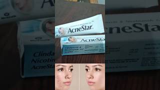 acnestar gel review  acnestar gel kaise use kare youtubeshorts shortsvideo shorts ytshorts [upl. by Saeger]