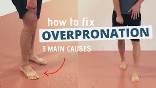 Pronated Feet and How to Fix 3 Different Causes of OVERPRONATION [upl. by Terrill]