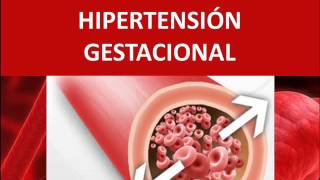 Hipertensión gestacional  Fisiopatología [upl. by Rafaela9]