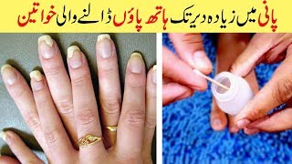 Get Rid of Toenails Fungus Natural Treatment amp Cure Simple Home Remedies Urdu Hindi [upl. by Adria181]