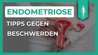 Pille Schmerzmittel amp Alternativen Die besten Tipps für Endometriose und Adenomyose [upl. by Kreiner]