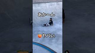 【お尻の◯ナが…】shorts スケボー スケボーキッズ skateboarding 痛い おしり おもしろ やばい 病院 激痛 暑いリベンジひなぴーたオリンピック 裏 [upl. by Amehsat491]