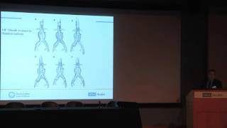 Endovascular Treatment of Ruptured Aortic Aneurysms – Before During and After [upl. by Galligan]