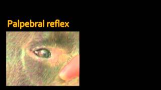 Palpebral and corneal reflexes [upl. by Ecirum]