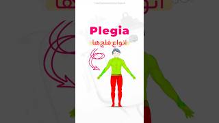 Let me explain different types of plegia 👨‍🦽 shorts medical neurology [upl. by Prowel562]