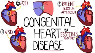 Congenital Heart Malformations Made Easy 8 Main Types [upl. by Eilata]