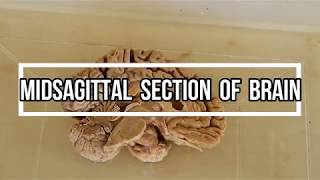 Midsagittal Section of Brain  neuroanatomy [upl. by Naitsirhc254]