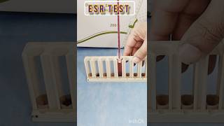 Esr westergren method  ESR test means  What does ESR lab test showlaboratory test bloodtest [upl. by Cris]