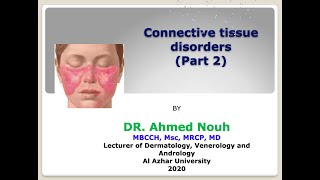 Connective tissue disorders part 2 [upl. by Ettena132]