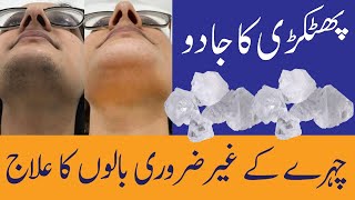 Face Hair Removal  How to remove hair from face  Face hair removal for women at home [upl. by Sharron790]