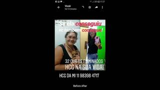 Dieta HCGOVIDAC 10000uis e HUCOG 10000uis Maravilhosos 11 983984717 HCG injetável O melhor [upl. by Blayze388]