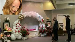 Adalia Rose last journey video Adalia Rose has passed away [upl. by Aicaca594]