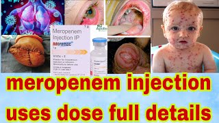 meropenem injection ip 1gm in hindi  meropenem injection uses in hindi Gyanear [upl. by Cynthea371]