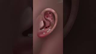 ASMR getting parasites out of a ear [upl. by Anairb]