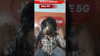 Day 5 use minoxidil morr f5 result  adivasi hair oil results haircare adivasihairoil minoxidil [upl. by Dzoba]