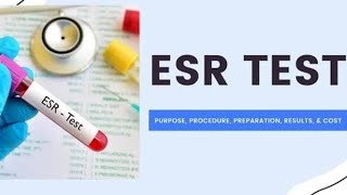 Erythrocyte sedimentation rate [upl. by Ailahs]