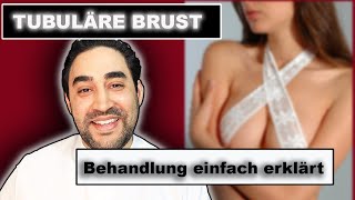 TUBULÄRE BRUST  Die Behandlung einfach erklärt  Dr Alawi [upl. by Amerak148]