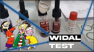 WIDAL TEST  SLIDE AGGLUTINATION TEST  TYPHOID FEVER  MICROBIOLOGY  MBBS  REVISION [upl. by Nageam986]