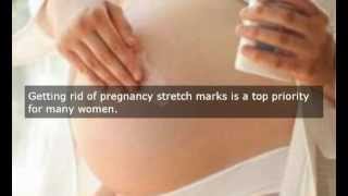 How To Remove Stretch Marks After Pregnancy [upl. by Htebizile]