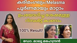 കരിമംഗല്യം ഇനിയൊരു പ്രശ്നമല്ല Herbal Anti Melasma Face pack  Mukhavarnya Tailam melasmatreatment [upl. by Auohp]