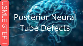 USMLE Step 1  Posterior Neural Tube Defects [upl. by Essirehs687]