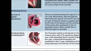 Heart failure treatment 24 [upl. by Xirtaeb]