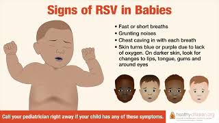 Signs amp Symptoms of RSV in Babies  AAP [upl. by Nomolos]