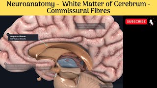 White Matter of Cerebrum  Commissural Fibres  Corpus Callosum  Commissures [upl. by Gluck923]