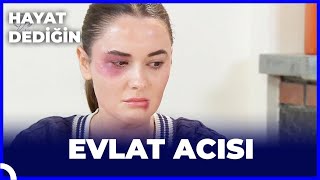 Hayat Dediğin  Evlat Acısı [upl. by Nitsirc]