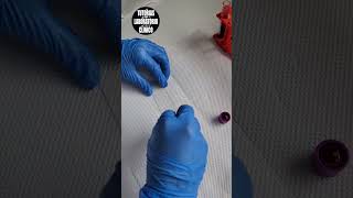 🩸¿Como Hacer un FROTIS SANGUÍNEO Extendido de Sangre Periférica 🔬Tutorial Laboratorio Clínico P2 [upl. by Kcirtap]