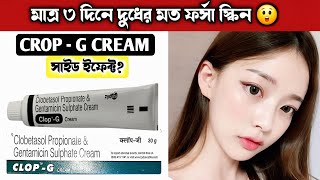 Clop G Cream এর কাজ কি  ত্বক ফর্সাকারী ক্রিম  Clop G Cream Review  Clop G Cream [upl. by Streeto]