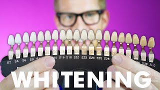 Get CRAZY WHITE Teeth  Best Teeth Whitening Products That Work  Chris Gibson [upl. by Val544]