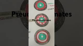 Coelom  Body cavity  Acoelomates  Pseudocoelomates  Eucoelomates [upl. by Angadresma332]