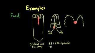 Schneid Guide to Neurological Lesion Localization [upl. by Enaamuj]