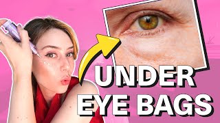 How To Get Rid Of Under Eye Bags amp Puffy Eyes  Dr Shereene Idriss [upl. by Danaher]